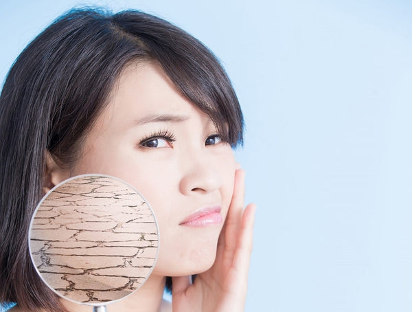 8 Ways To Stop Dry Skin In Winter Months