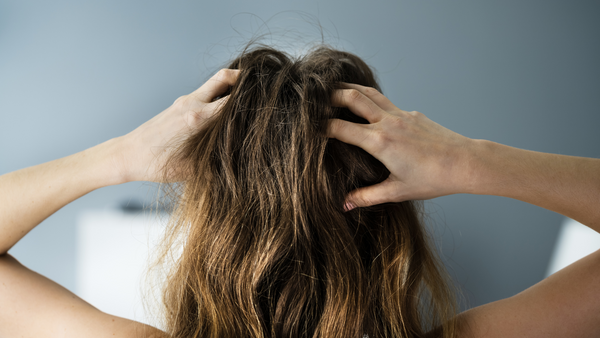 Finding Relief: A Comprehensive Guide on How to Stop an Itchy Scalp