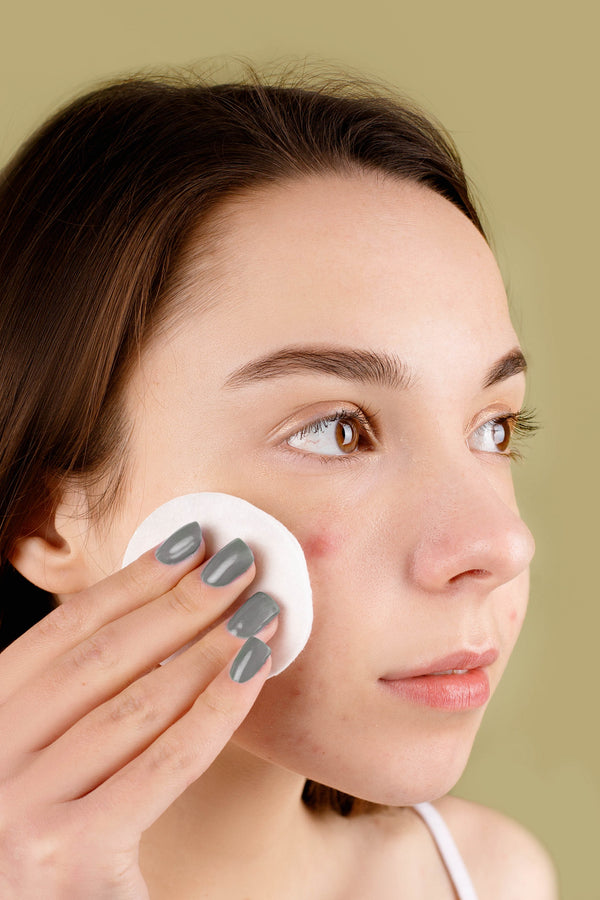 Do Pimple Patches Worth All The Hype?