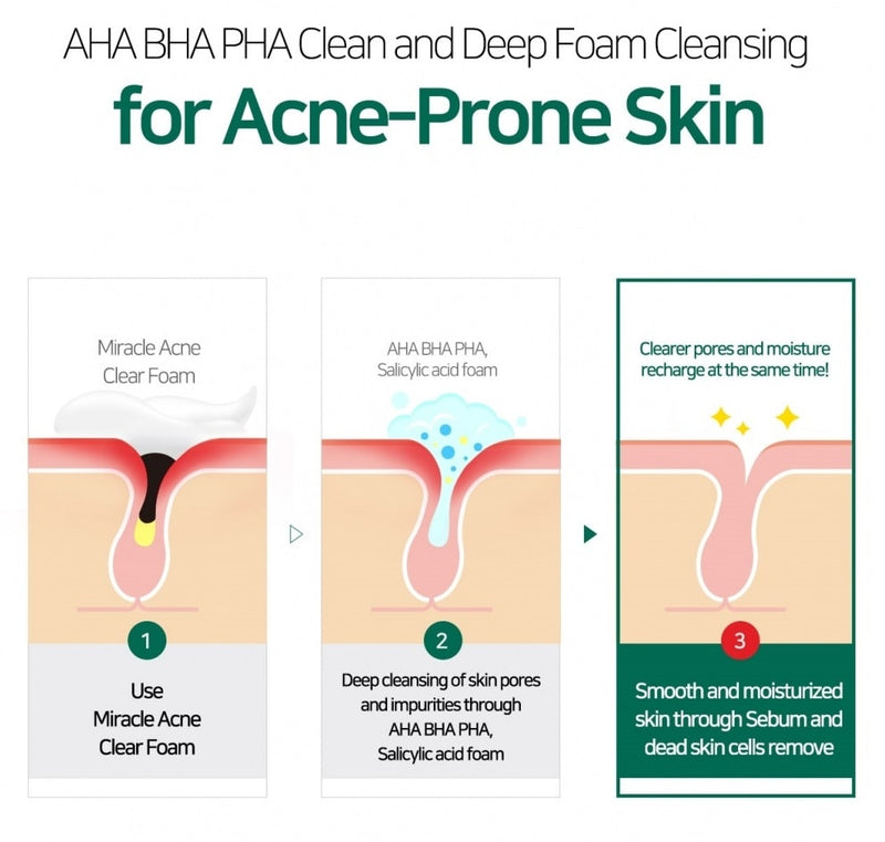 AHA, BHA, PHA 30 Days Miracle Acne Clear Foam (100ml)